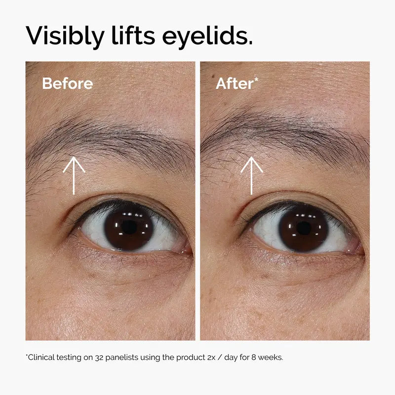Lacto-PDRN 4% + B9 Firming & Brightening Eye Cream | Buy 2 Get 1 Free