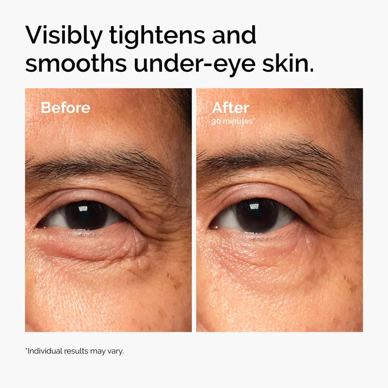 Lacto-PDRN 4% + B9 Firming & Brightening Eye Cream | Buy 2 Get 1 Free