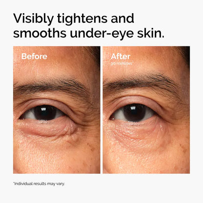 Lacto-PDRN 4% + B9 Firming & Brightening Eye Cream | Buy 2 Get 1 Free